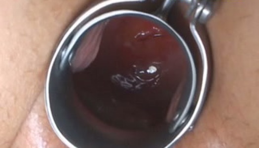 Emotionless chick with flossy ass gets her wet cunt fisted hard at home porn pics