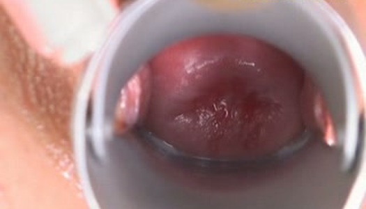 Brunette Olivia is a great pro in fisting her wet pussy for multiple orgasm porn pics